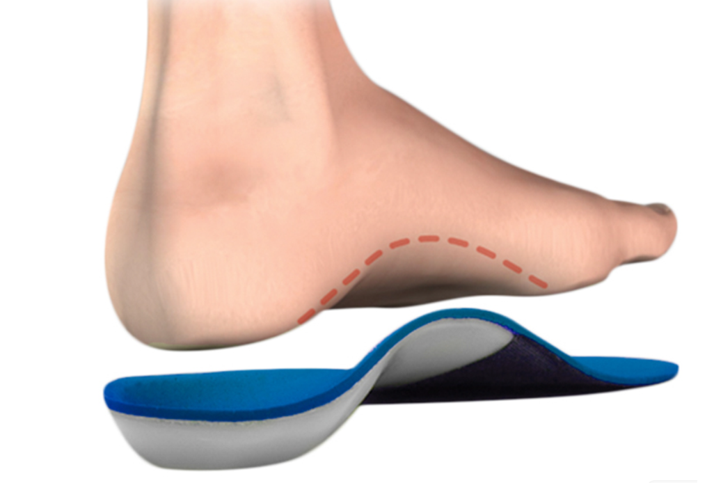 Детские ортопедические стельки: супинатор, размер, показания
